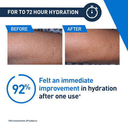 Cerave, Intensive Moisturising Lotion, with Hyaluronic Acid, 3 Essential Ceramid